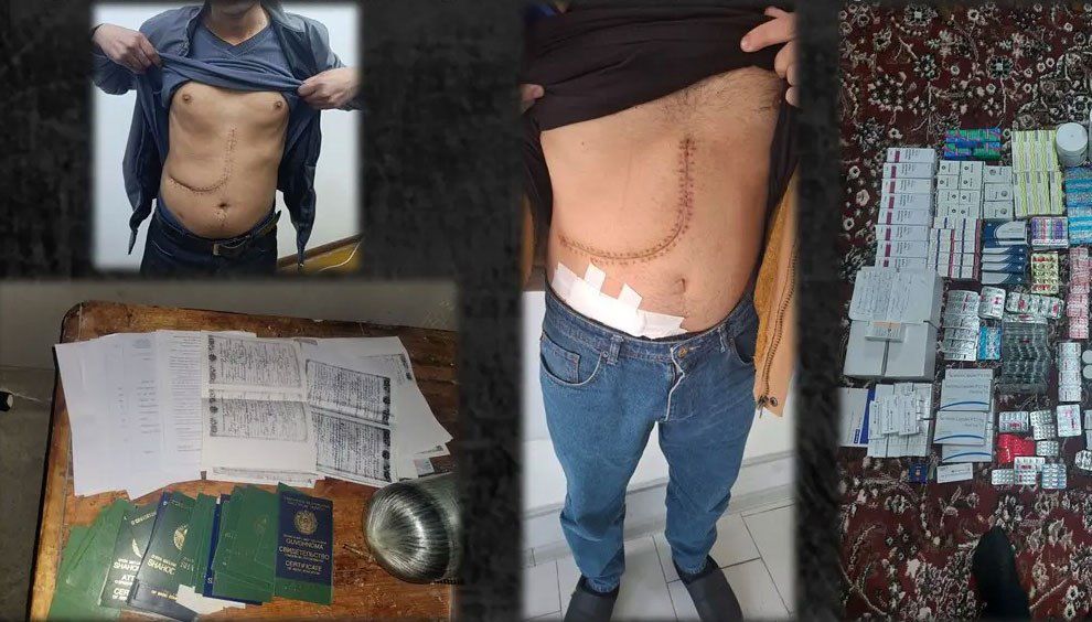 Inson organlari va to‘qimalari savdosi bilan shug‘ullangan uyushgan jinoiy guruh fosh etildi